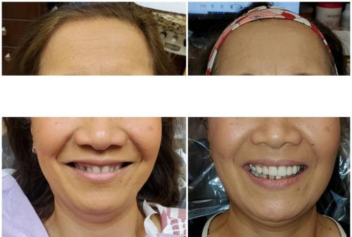 20220108_124014-2048x1386