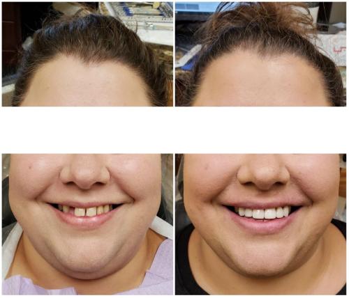 20220108_124304-1-2048x1753