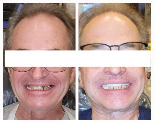 20231128_223415-2048x1638